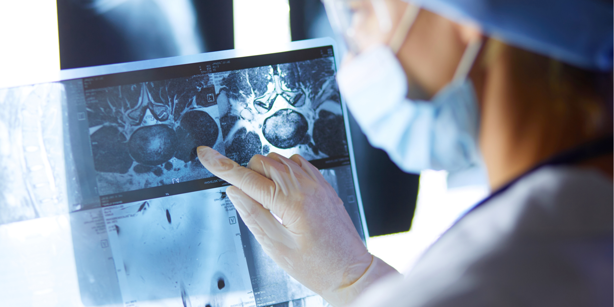 Supporting Biotech and Pharma Companies Using Imaging Endpoints in Clinical Trials